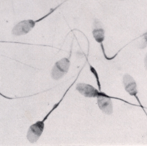 3762-92495-sperm1.jpg