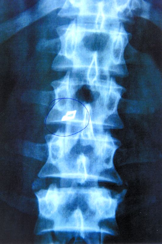 3770-94280-radiografie.jpg