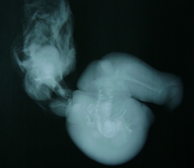 0-117964-fetusi.jpg