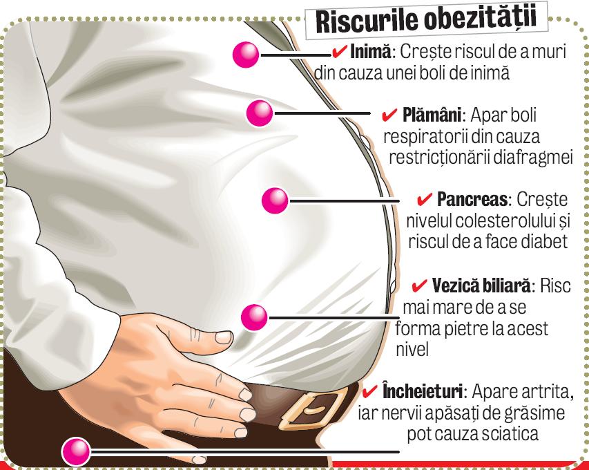 3879-119061-riscurileobezitatii.jpg