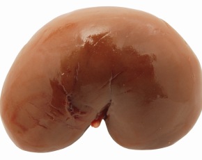0-132837-front_kidney.jpg