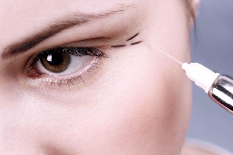0-149608-botox.jpg