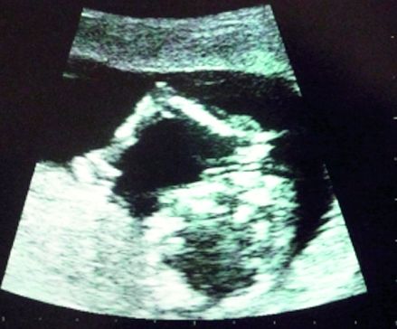 4019-150620-ecografie.jpg