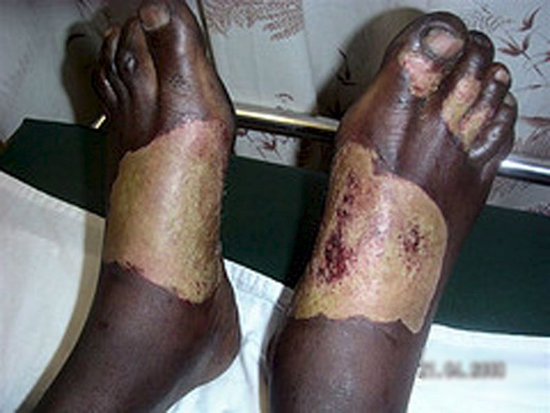 0-158479-legs.jpg