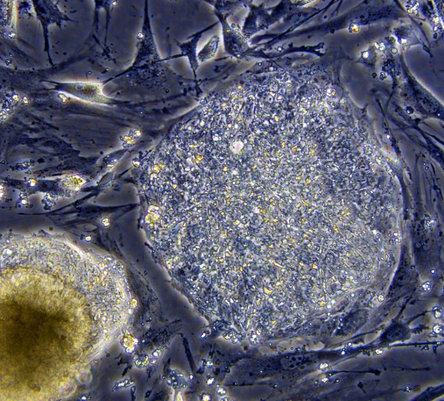 0-170203-cell.jpg