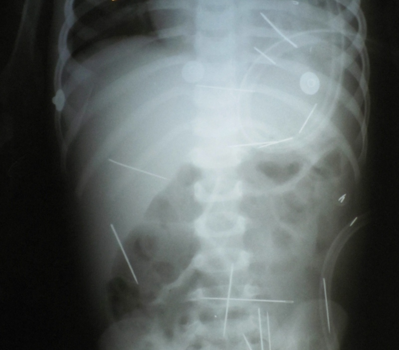 0-210595-ace.jpg