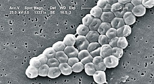 4317-228314-89actacinetobacter_baumannii.jpg