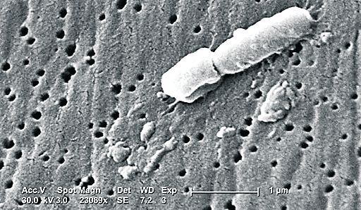 4317-228317-89actklebsiella21121216417732199071692972.jpg