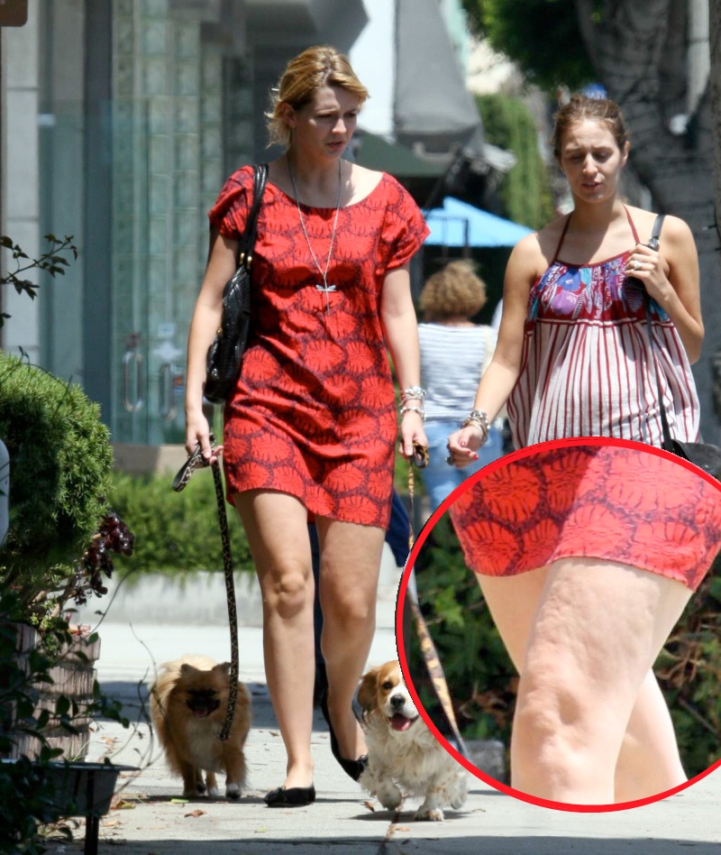 Mischa Barton are picioarele pline de celulita