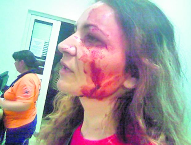 Aşa arăta Maria Niţă în seara în care a fost bătută de Sile Pietroi
