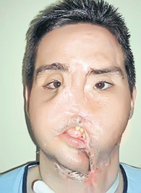 4479-276993-inainte_de_transplant.jpg