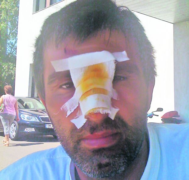 Arbitrul Sergiu Olariu (37 de ani) a suferit o fractură nazală, după ce a fost izbit pe pista raliului de la Caransebeş