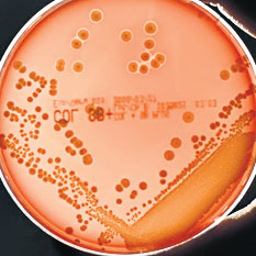 4499-282754-bacteriaucigasa.jpg