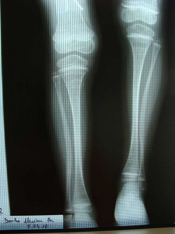 0-288033-radiografie.jpg