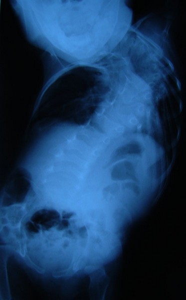 4631-318639-radiografiainainte.jpg