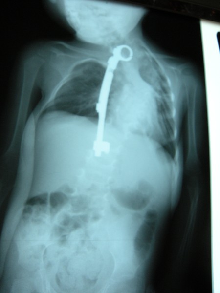 4631-318640-radiografiedupa.jpg