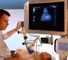 Revascularizarea inimii cu ajutorul undelor acustice - CardioFort