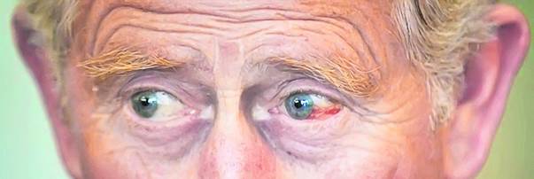 Psihologul Bonnie Eiker Weil a concluzionat, după decizia Prinţului William de a refuza să poarte verighetă: «E predispus să înşele»