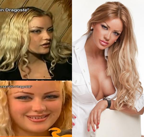 5 schimbări spectaculoase ale vedetelor