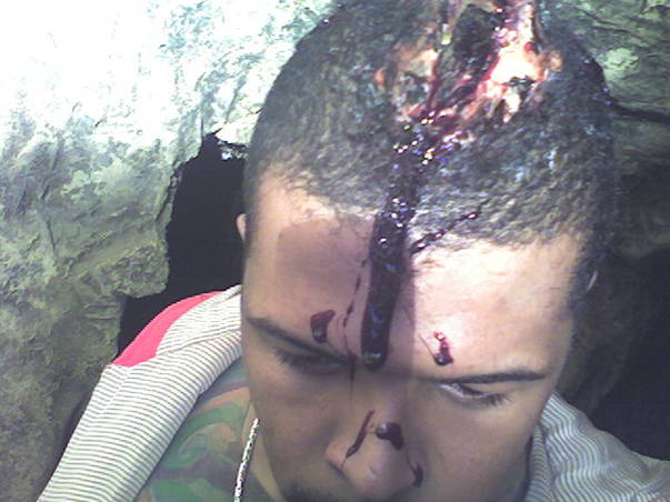 Cabral, accidentat pe zebră