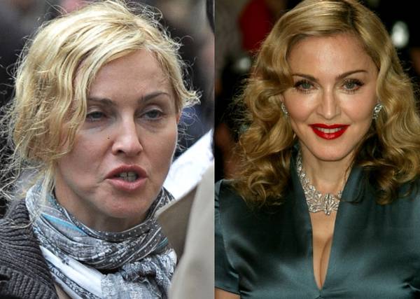 Madonna