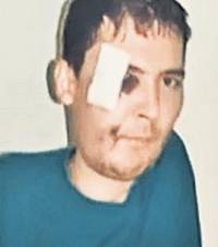 Mașina l-a acroșat pe Iulian în timp ce el traversa legal, în scaunul cu rotile, pe trecerea de pietoni (medalion). În urma impactului, tânårul a fost lovit la ochi şi la gură