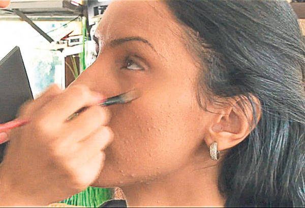 Foto | Și vedetele se luptă cu coșurile