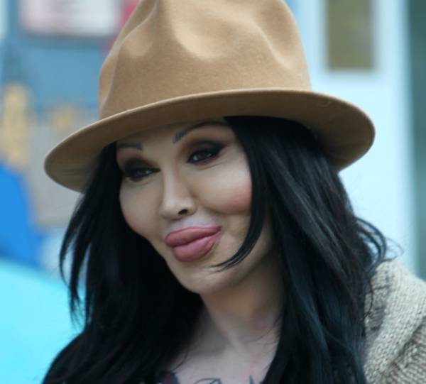 Pete Burns