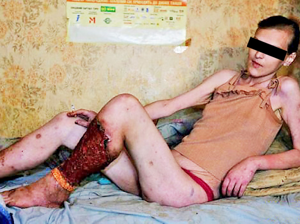 INTERZIS MINORILOR! IMAGINI EXPLICITE! Efectul drogului "Croco"