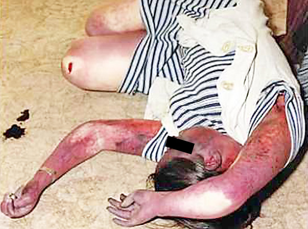 INTERZIS MINORILOR! IMAGINI EXPLICITE! Efectul drogului "Croco"