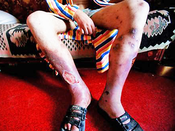 INTERZIS MINORILOR! IMAGINI EXPLICITE! Efectul drogului "Croco"