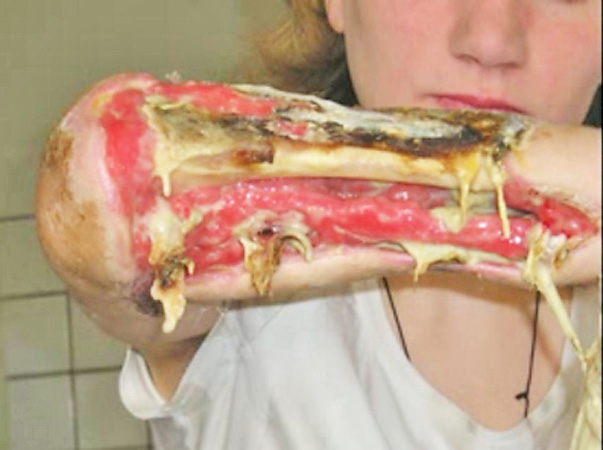 INTERZIS MINORILOR! IMAGINI EXPLICITE! Efectul drogului "Croco"