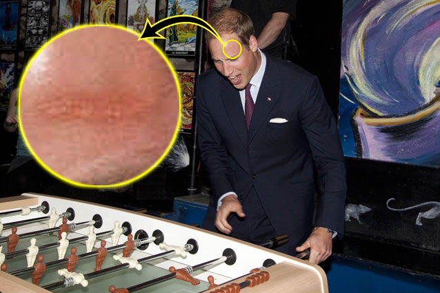 Foto | Imaginea care a şocat Marea Britanie şi a făcut presa să strige "Ce-a păţit Kate Middleton la cap?"