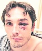 Andrei Condoianis, avocatul bătut de cântăreţ în 2005, îl execută silit pe acesta: "Pepe dansează pentru mine"