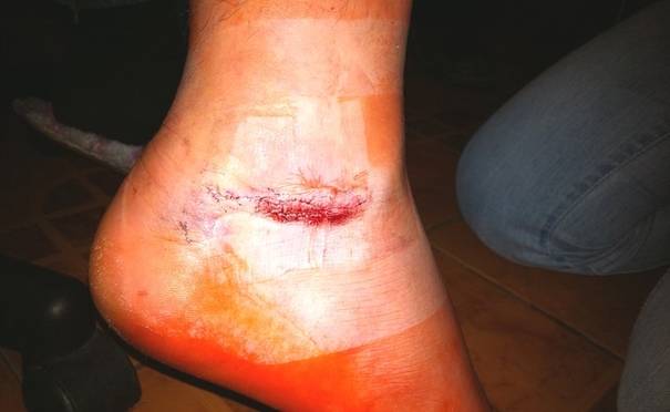 Marian Drăgulescu şi-a pus cariera în pericol din cauza operaţiei de la picior: "Am riscat pentru Olimpiadă" | FOTO