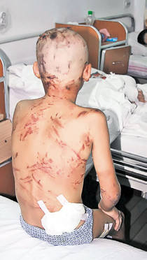 Robert Lorentz: «Avem deja 2.000.000 de maidanezi în România»