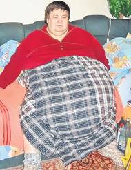 I-au scos peste 70 kg de grăsime din burtă!