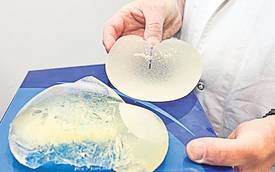 Protezele erodate, prezentate de doctori