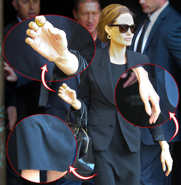 angelina jolie anorexica
