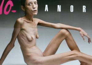 Scheletică şi cu hainele murdare, diva şi-a făcut apariţia în public | FOTO
