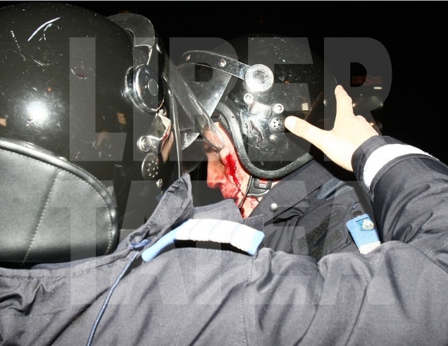 Iată cele mai şocante imagini de la protestele violente de sâmbătă | FOTO