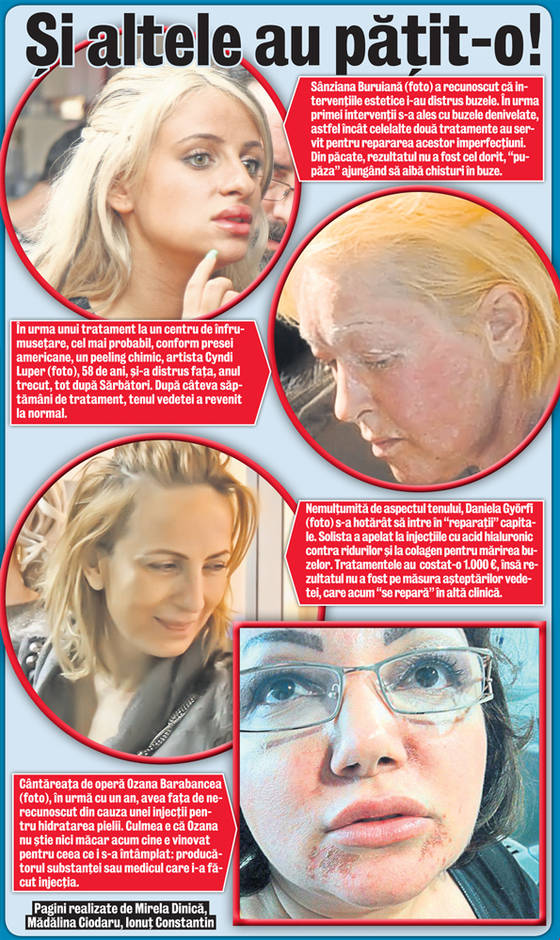 Laurette, nu suferi singură! Şi pe ele le-au nenorocit tratamentele de frumuseţe | VIDEO