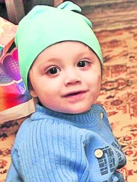 Un lung şir de operaţii i-a redat chipul micuţului Alexandru (2 ani)