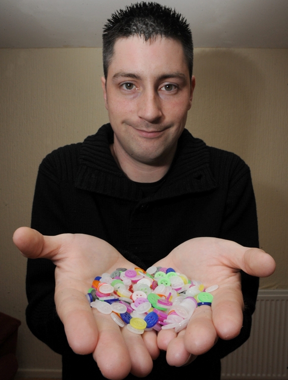 Alex Torrance, bărbatul chinuit 20 de ani de o cumplită frică de nasturi 