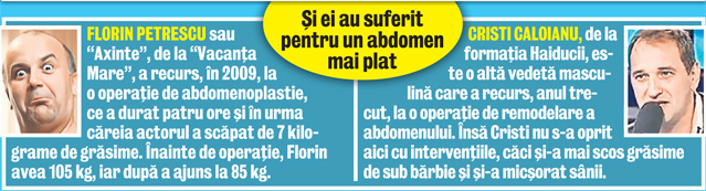 Costin Mărculescu se operează, din doi în doi ani, ca să arate pe plajă ca Făt-Frumos