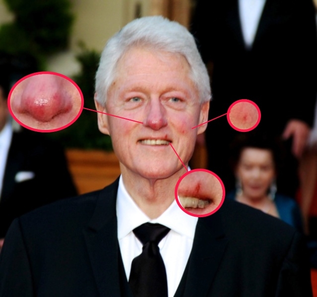 Bill Clinton Bill Clinton