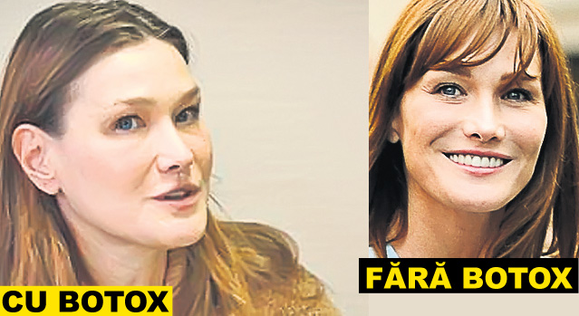 Zici că-s împăiați! Staruri de la Hollywood și politicienii celebri și-au distrus fețele cu prea mult botox