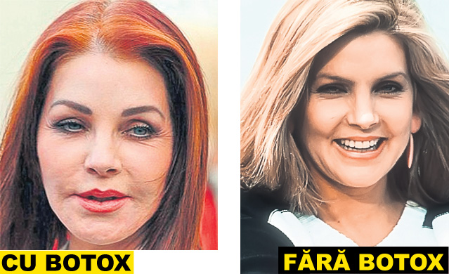 Zici că-s împăiați! Staruri de la Hollywood și politicienii celebri și-au distrus fețele cu prea mult botox