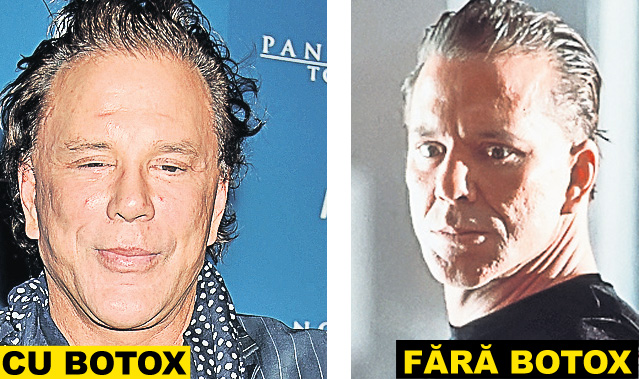 Zici că-s împăiați! Staruri de la Hollywood și politicienii celebri și-au distrus fețele cu prea mult botox