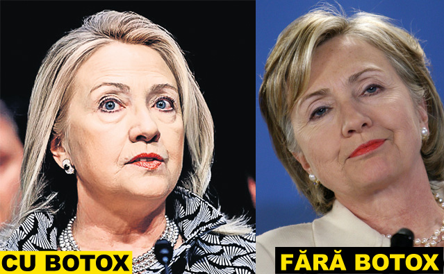 Zici că-s împăiați! Staruri de la Hollywood și politicienii celebri și-au distrus fețele cu prea mult botox